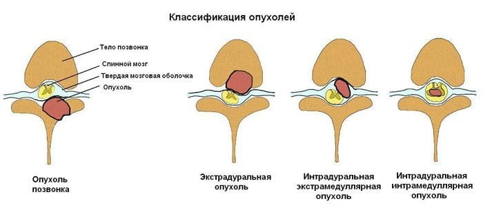 Спинной мозг фото в разрезе